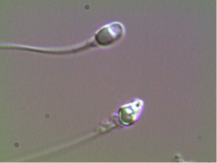 Comparacion espermatozoide normal con amorfo y vacuolado.