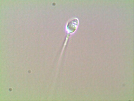 Espermatozoide con pequeñas vacuolas