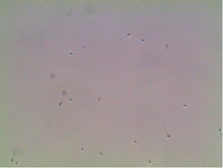 Espermatozoides a 200 aumentos SIN IMSI.